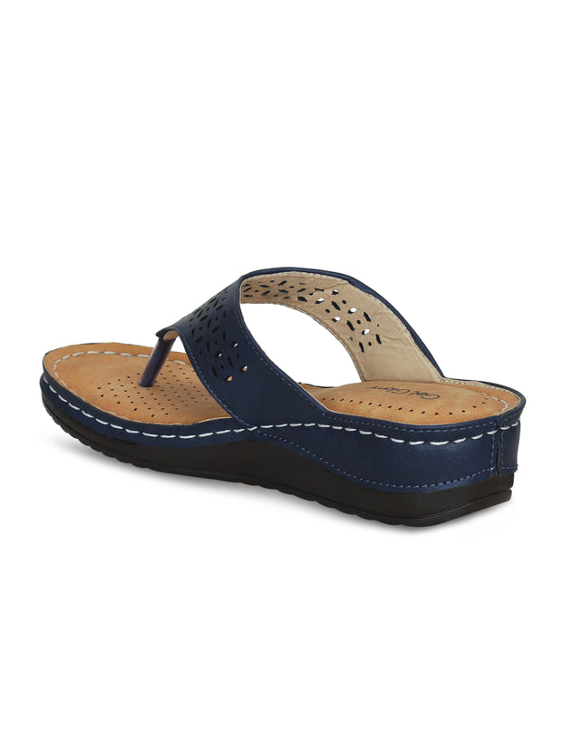 Women Navy Blue Solid Open Toe Platform Sandals
